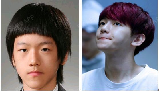 [韩国整形]男性轮廓手术中心伯贤(baekhyun)是中韩男子团体组合exo