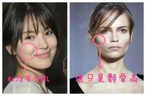 面相学里有句俗话:女人颧骨高_圈子-新氧美容整形