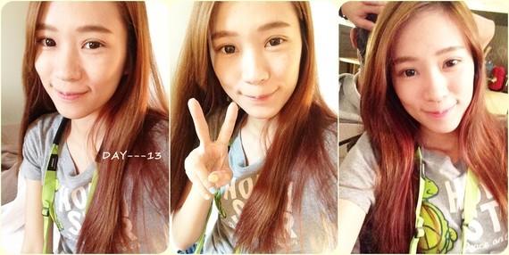 kellyyang埋线双眼皮第16天美丽日记