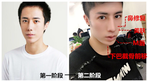 首页 此页面仅支持预览 Avatar 新氧达人堂 109篇日记 大变脸 他撞脸了张一山等半个娱乐圈儿男星 本期堂主很有幸约访到了平台上的大红人 也是咱们达人堂里大神级的人物 刘泽雨 每每看泽雨宝宝的照片 虽然身为直男 都觉得老tm帅了 约见之前