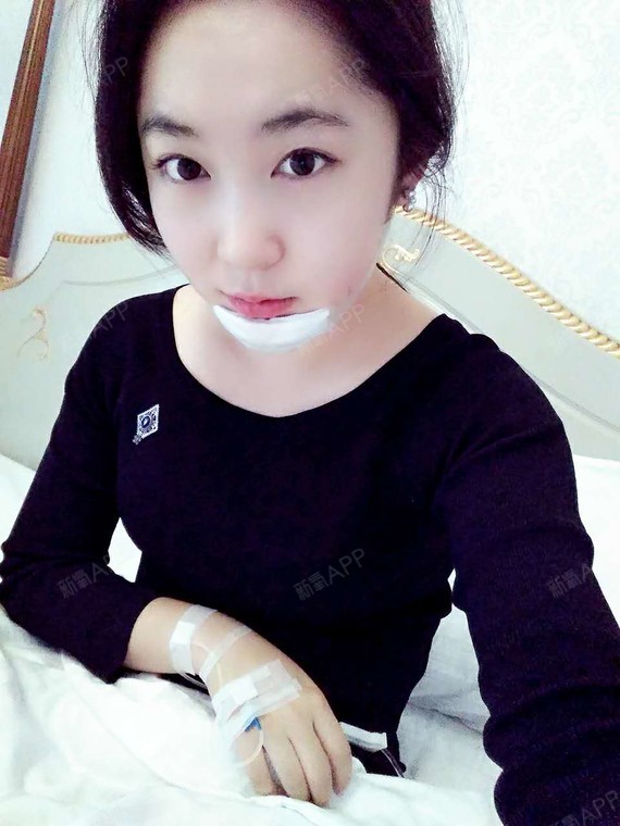 无恙小婷子膨体垫下巴第0天美丽日记