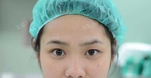 少女小鱼一单一双眼皮 无痕缝线式双眼皮立即改善