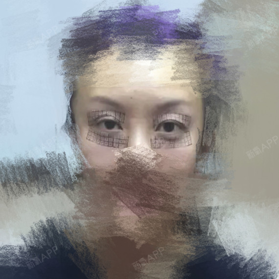 首页 此页面仅支持预览 Avatar 池星洲zi 1篇日记 不到40岁 却老得很快 特别是眼周 过多暴露年龄 直入主题 做了眼部热玛吉 眼部热玛吉疗程之前需要在双眼的上下眼皮敷上表皮麻醉 也要滴上麻醉眼药水并戴上眼球保护片 一切准备就绪 还需要在