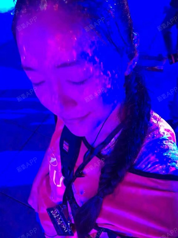 玻尿酸垫下巴好不好_效果图_千鸢浅语玻尿酸垫下巴术后第3天_新氧美容