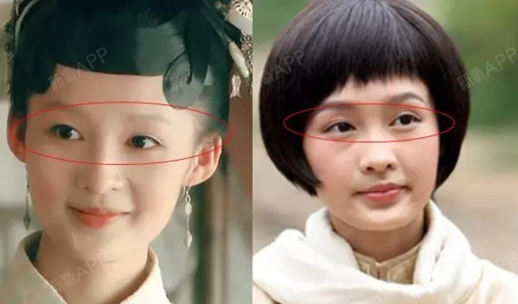 韩国欧佩拉整形外科