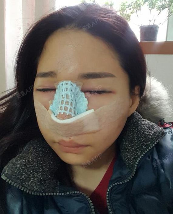 面部轮廓整形专家_脸部轮廓整形专家_轮廓整形医生排名
