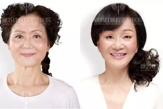 同样20 ,为何你比她显老?一群女人在一起嗨,最害_圈子-新氧美容整形