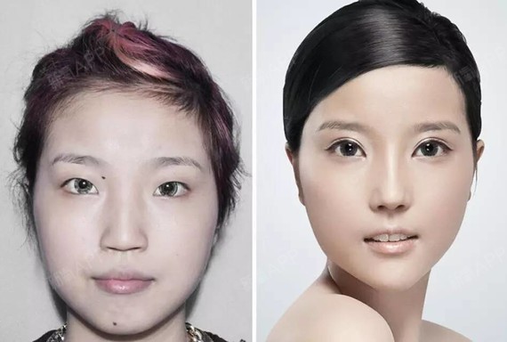 20名女子公布整容前后照片 鬼斧神工让人惊叹!
