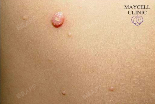 今日薛友轸院长美丽课堂主题