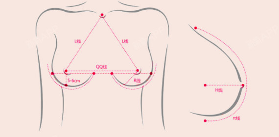 假体隆胸划线设计图片