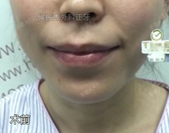 侯振杰外科正牙
