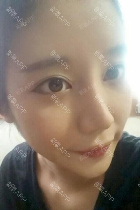 无锡腋臭微创手术价格多少钱合适啊,刚才看新