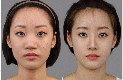 北京世熙医疗美容鼻部修复怎么样?