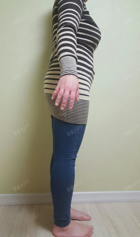 【吸脂瘦腹部第59天】我已经过了两个月._圈子-新氧美容整形