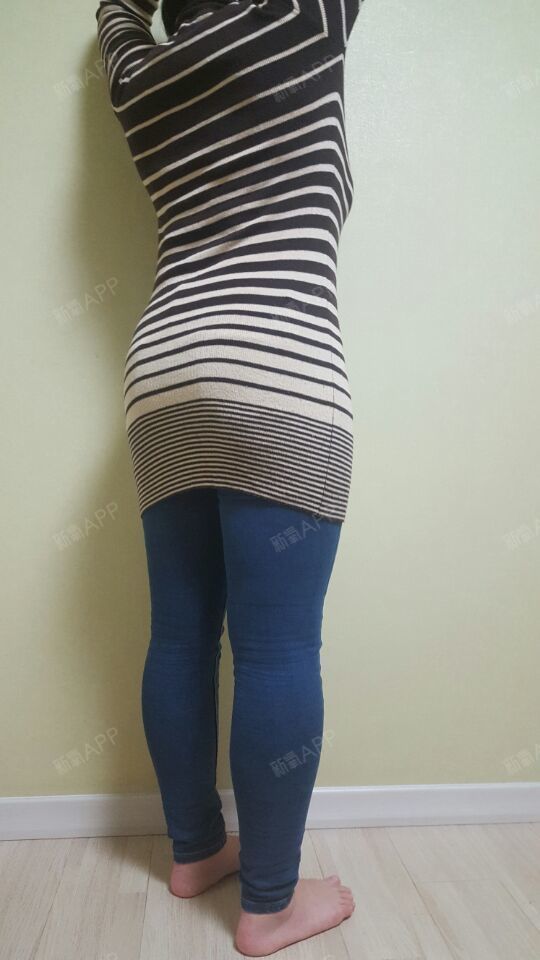 【吸脂瘦腹部第59天】我已经过了两个月._圈子-新氧美容整形