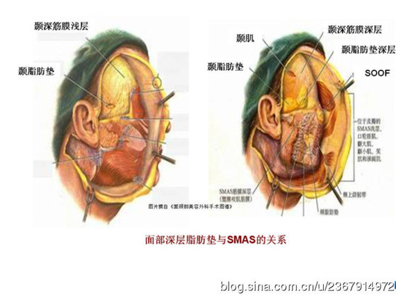 另一方面,就像我们在文章里面提到的soof脂肪垫和颧脂垫与泪沟,眼袋