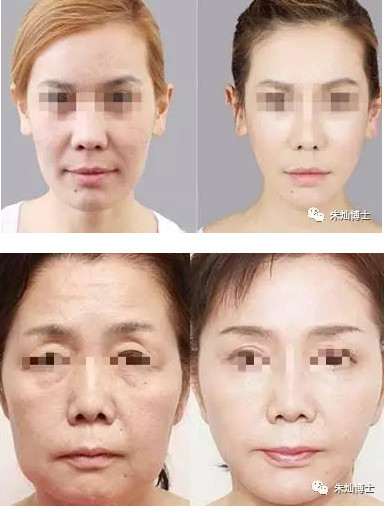 线雕:要问你做多少根!