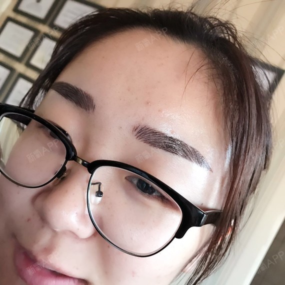 今天是纹完眉毛第一天,眉毛颜色很深,看起来怪怪的,_圈子-新氧美容