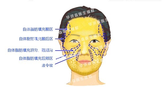 改善面部轮廓_脸部轮廓改善_面部轮廓整形的效果如何