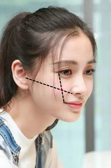 好多氧气们都很追求童颜感和少女感的颜,毕竟年轻总