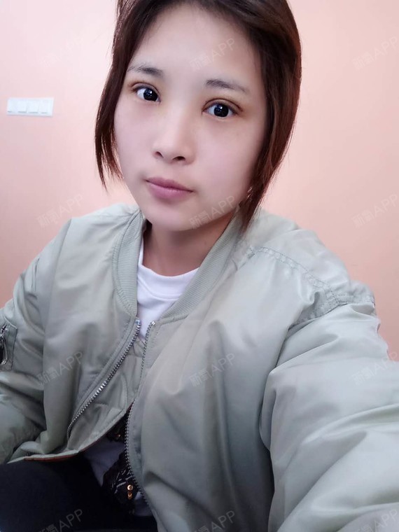 合肥眼部综合好不好_效果图_翩跹眼部综合术后第7天_新氧美容整形