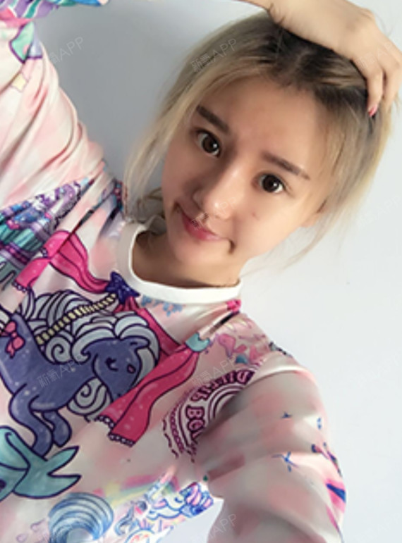 刚做完的时候有些肿 不过拆线后就恢复的很快 现在是拆线的第三天