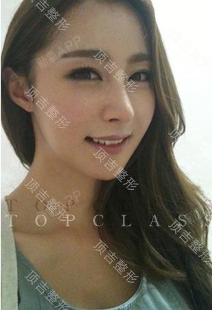 韩国topclass顶吉整形模特洪恩美