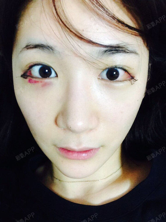 首先,我是有双眼皮的,不过我的眼尾比较上翘.