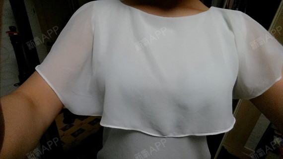 【德莱茵整形外科 - 缩胸提升手术】术后四个月