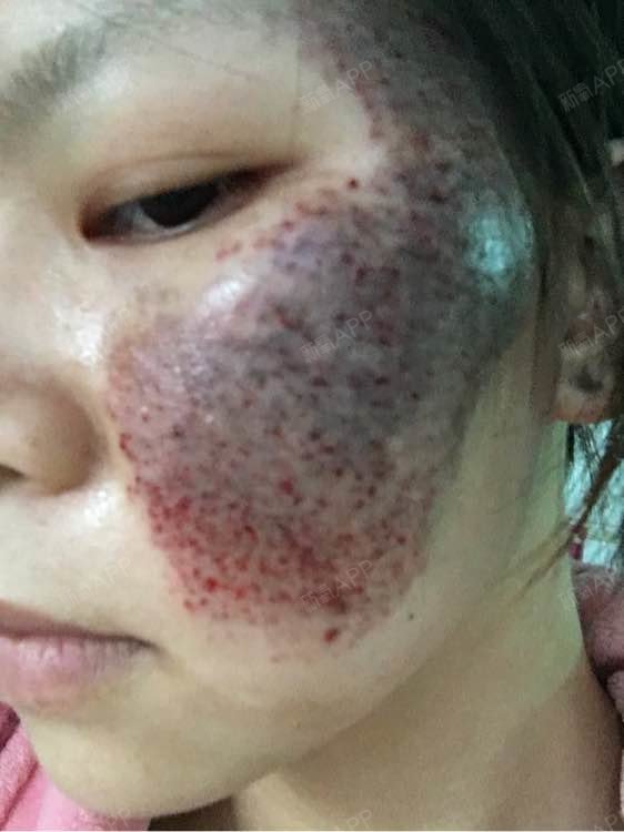 据说身上有胎记的人,上辈子都是特别重感情的,我想