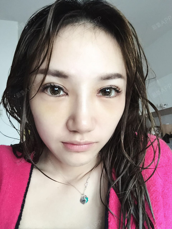 风靡日韩的魔力大眼术下睑下至