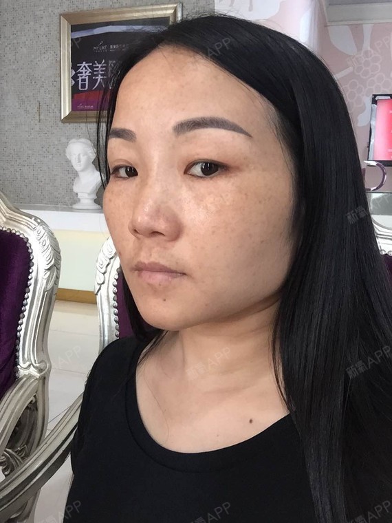 在新氧看过很多日记,这是第一次写,新氧很严谨,写一_圈子-新氧美容