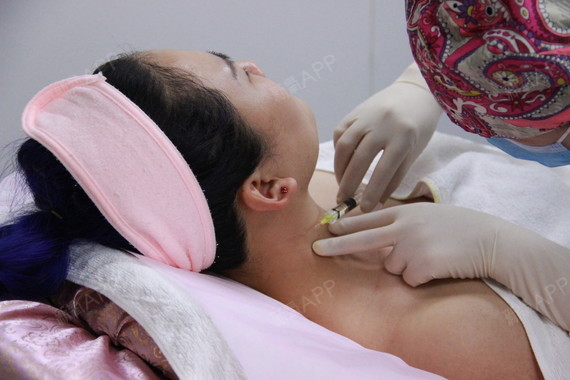 颈纹第二次注射先来一张让人心动的对比吧注射颈纹一个_圈子-新氧美容