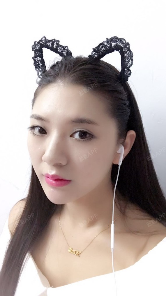 上星期填充完玻尿酸,现在的效果维持的好好