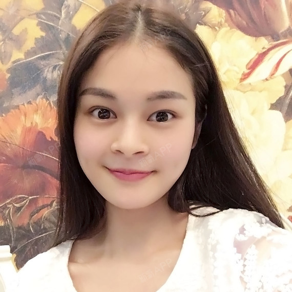 我的眼睛属于单眼皮中比较大的,眼睛有点像丹凤眼,但是令我很痛苦