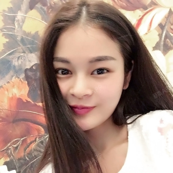 我的眼睛属于单眼皮中比较大的,眼睛有点像丹凤眼,但是令我很痛苦