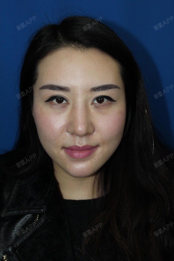 柳州美丽焦点整形