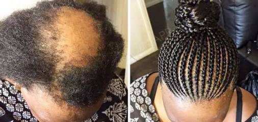 丸子头也可以用来遮盖地中海发型你造吗