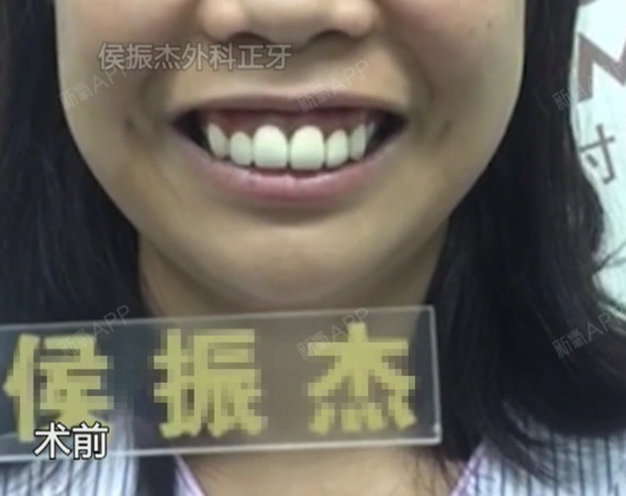 侯振杰外科正牙