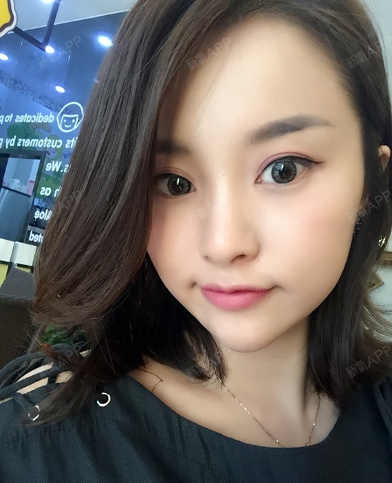 挺喜欢酷酷的自己~~总觉得说不上来啊,和之前的小圆_圈子-新氧美容