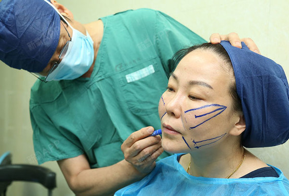 吼吼~~期盼已久的线雕手术终于完成啦!