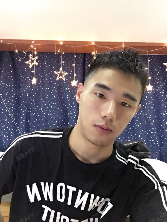 【武汉美天医疗*玻尿酸填充苹果肌】其实之前是从没有_圈子-新氧美容