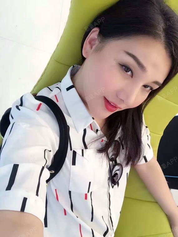 妖娆姐鼻综合术后第87天美丽日记_新氧整形