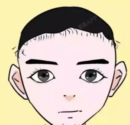 4,发际线呈m型