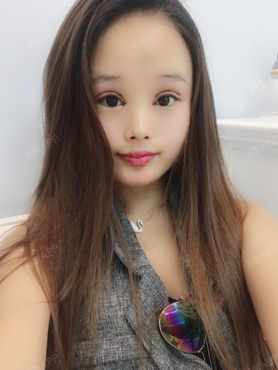 一直想拥有个双眼皮,羡慕大眼睛的女孩,以前我经常贴_圈子-新氧美容