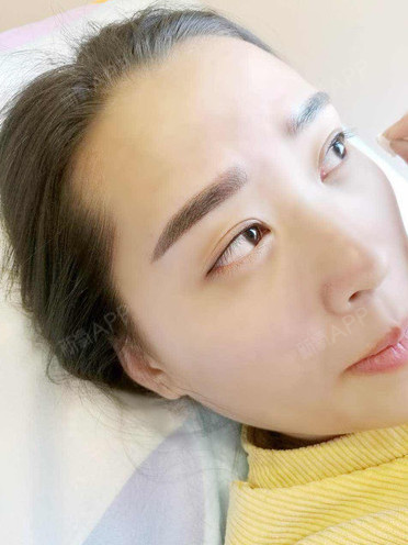 南京华美纹眉术后第5天