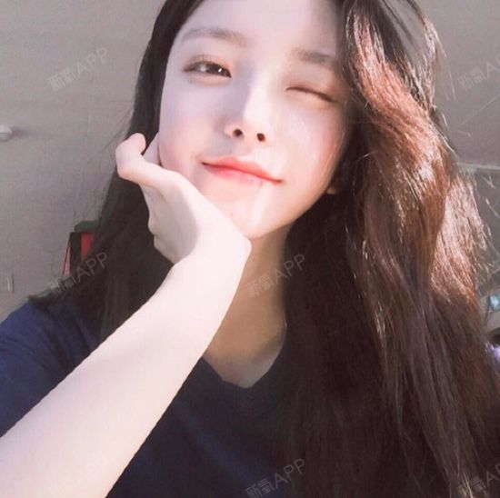 瘦脸针13天后的效果,咬肌是变小了,不知道还会不会缩小,维持多久