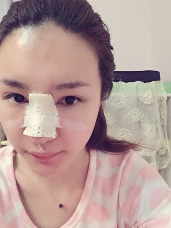 大连医美汇医疗美容刘野医生怎么样_好不好_挂号_整形案例-新氧整形