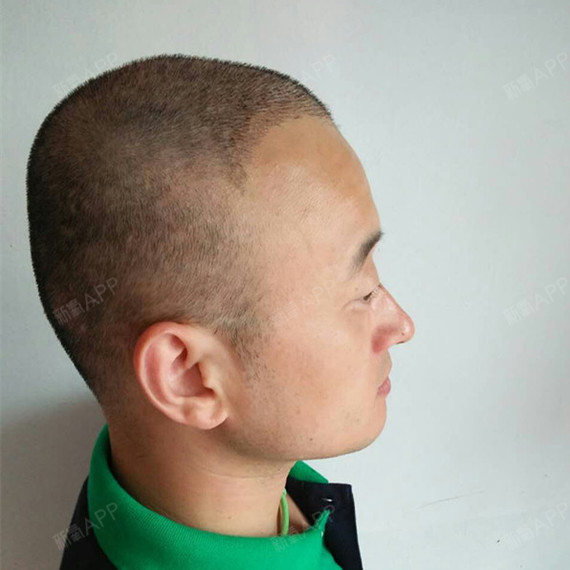 她们不太能接受后脑勺要剃