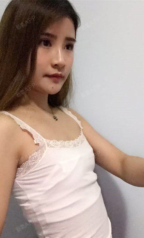 其实做自体脂肪隆胸前,我是犹豫拒绝的,因为担心的问_圈子-新氧美容